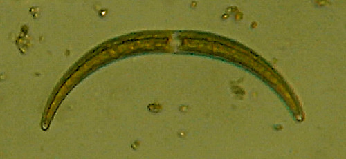 Closterium sp.